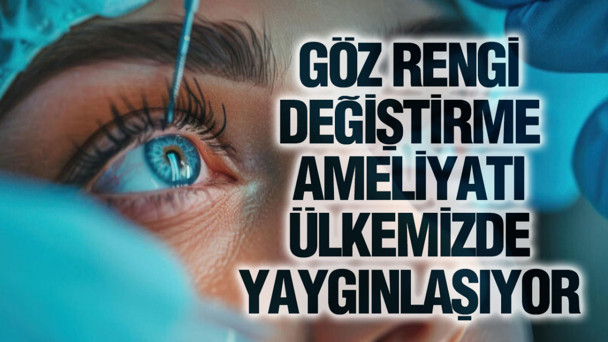 Göz Rengi Değiştirme Ameliyatı Ülkemizde Yaygınlaşıyor