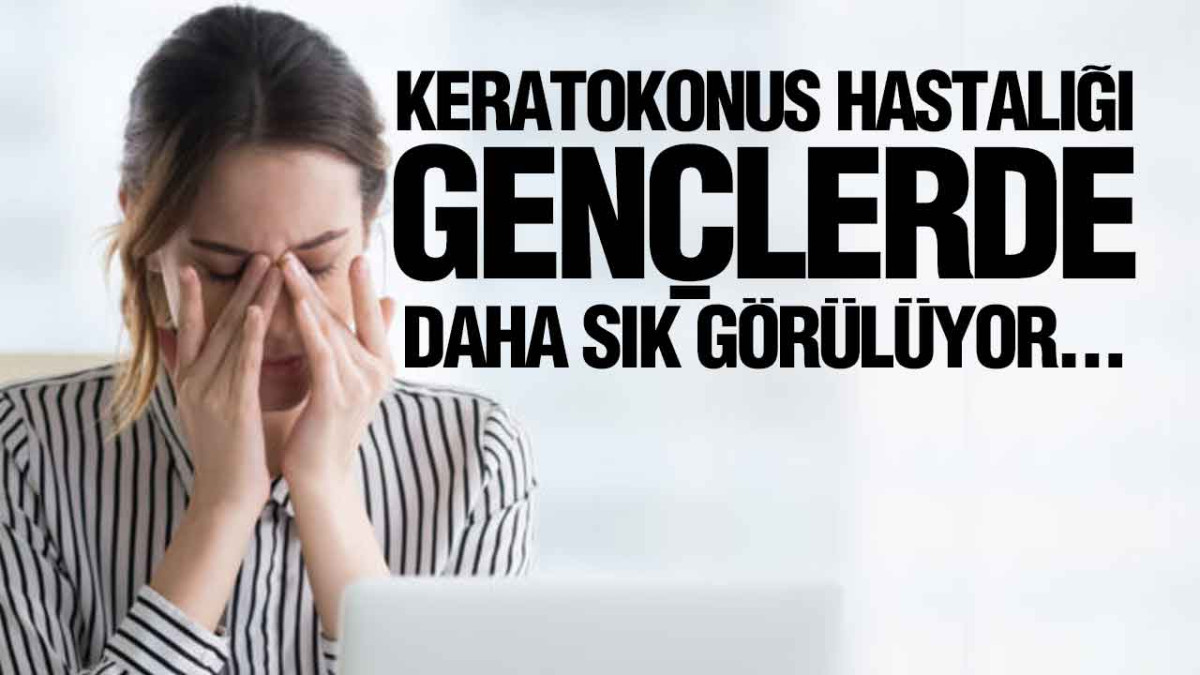 Keratokonus Hastalığı, Gençlerde Daha Sık Görülüyor...